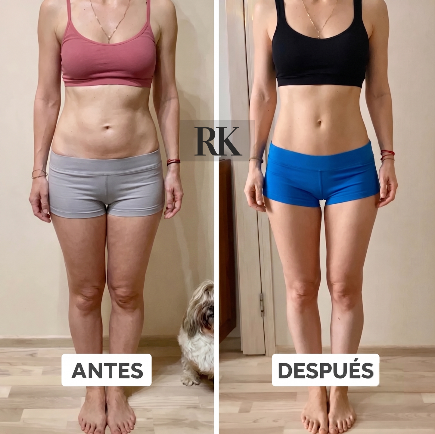 Lipo Lift RK™ - Crema Reafirmante Intensiva